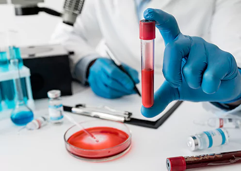 Exames Laboratoriais